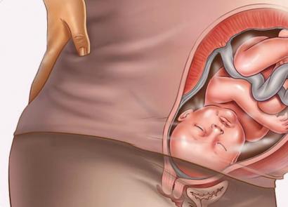 Was tun, wenn bei Ihnen ein Uterushypertonus diagnostiziert wird?